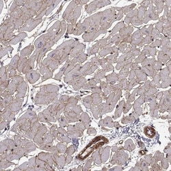 Laminin S/Laminin beta 2 Antibody, Novus Biologicals 25 &mu;L; Unlabeled:Antibodies,